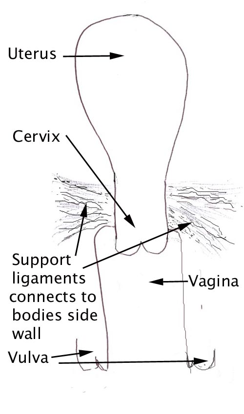  The lateral ( or side wall support) preventing prolapse